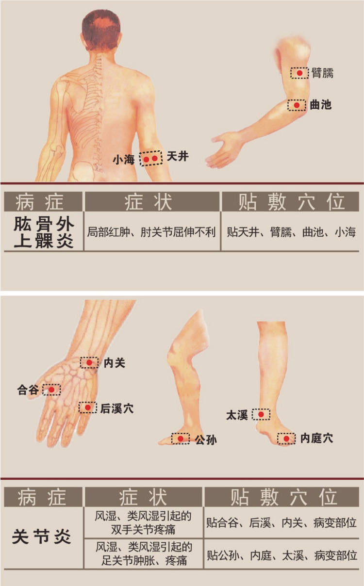 關節炎病癥貼敷穴位圖詳解-佰世修康