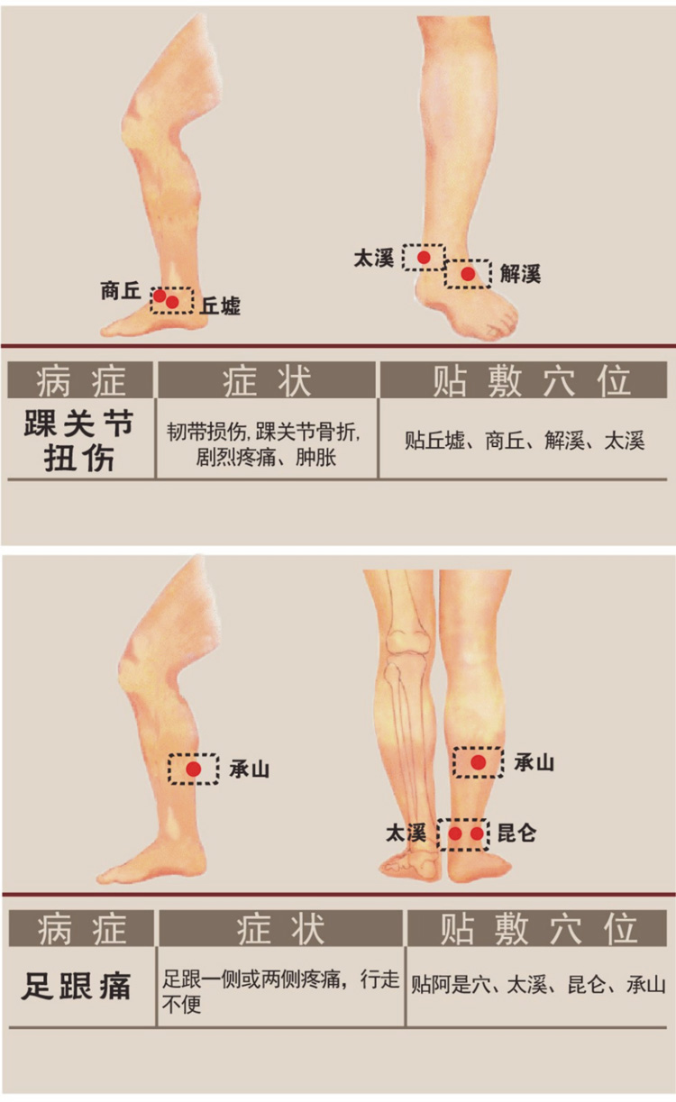 足關節疼痛貼敷穴位圖詳解