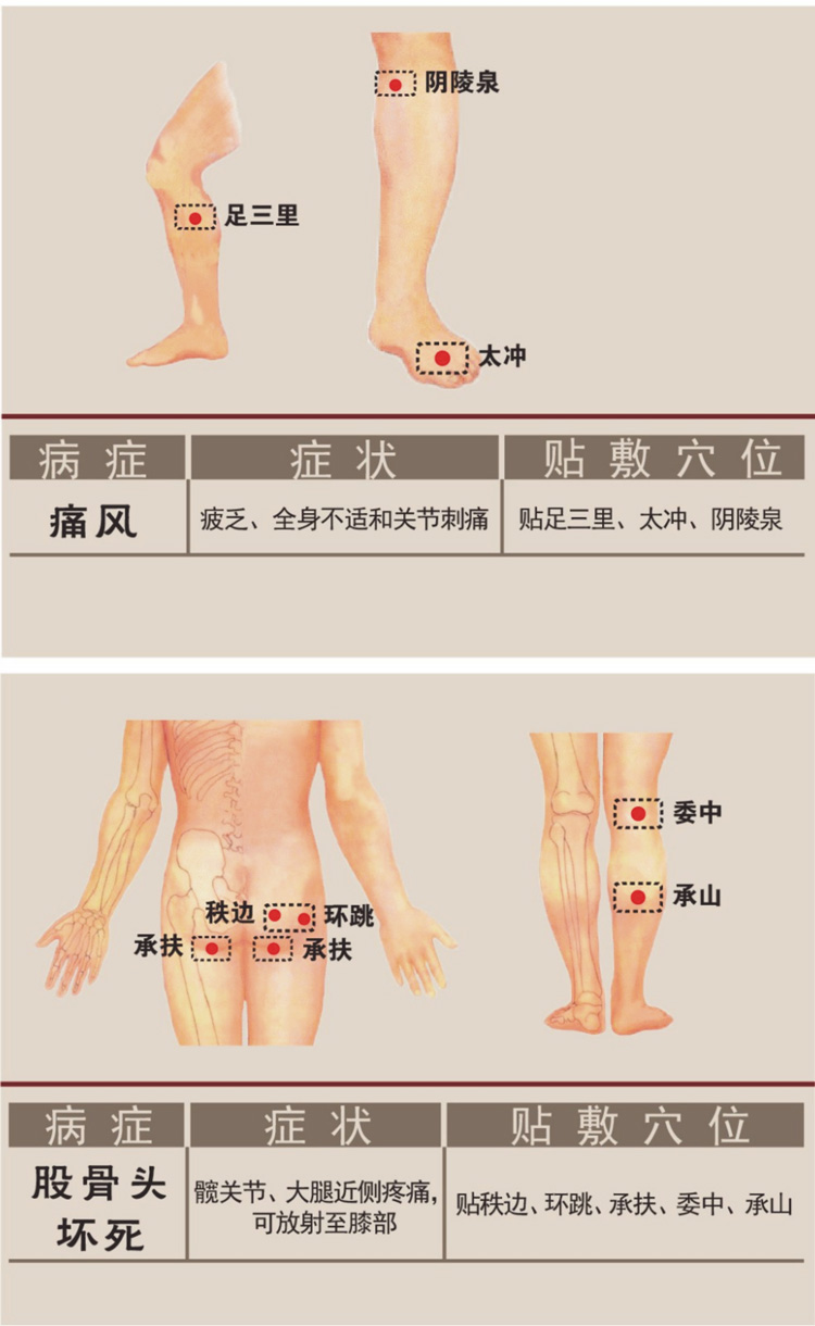 痛風癥狀膏藥貼敷穴位圖詳解